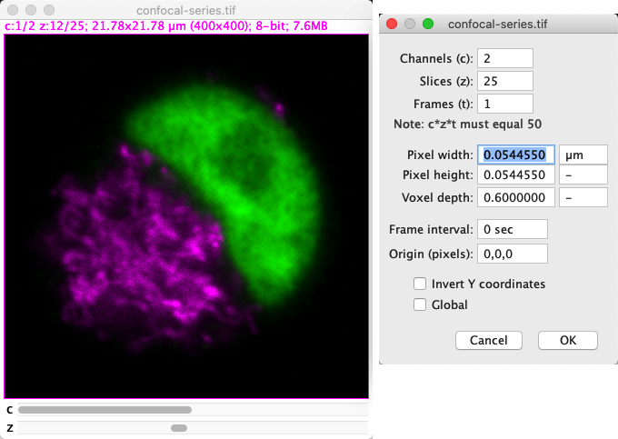 fiji imagej pixel count