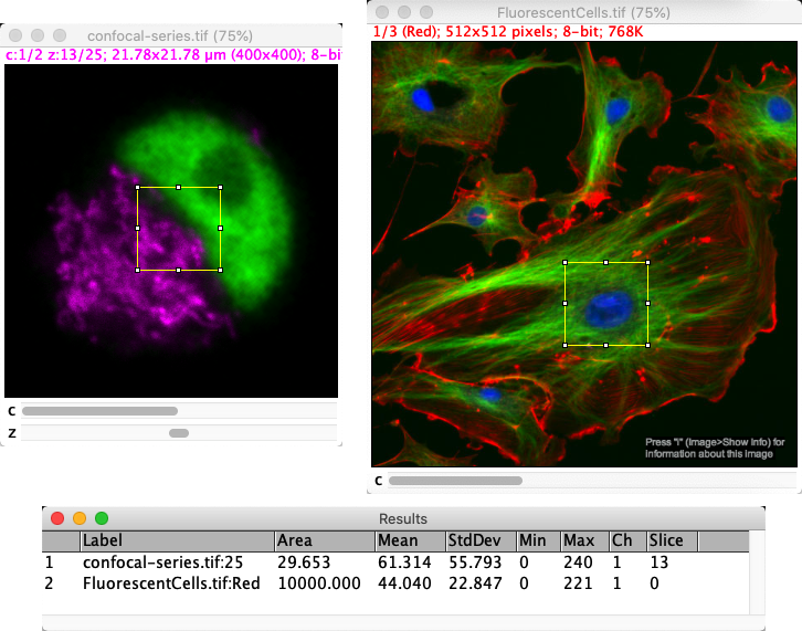 imagej-pixel-size-dimensions-introduction-to-bioimage-analysis