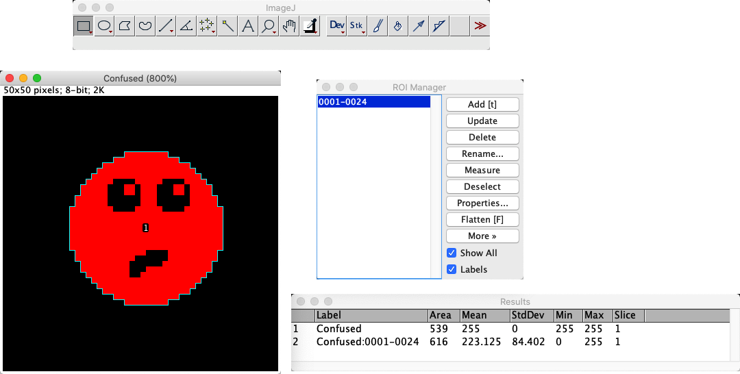 imagej threshold selection