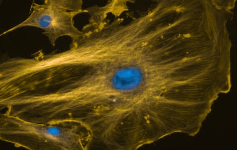 ../../../_images/fluorescent_cells_cb_crop.jpg